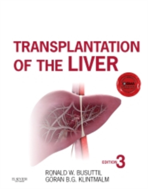 Transplantation of the Liver, EPUB eBook