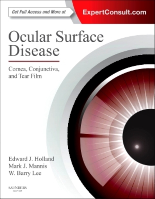 Ocular Surface Disease: Cornea, Conjunctiva and Tear Film : Expert Consult - Online and Print, EPUB eBook