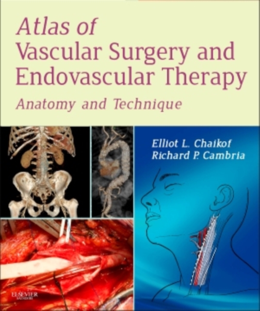 Atlas of Vascular Surgery and Endovascular Therapy : Atlas of Vascular Surgery and Endovascular Therapy E-Book, EPUB eBook