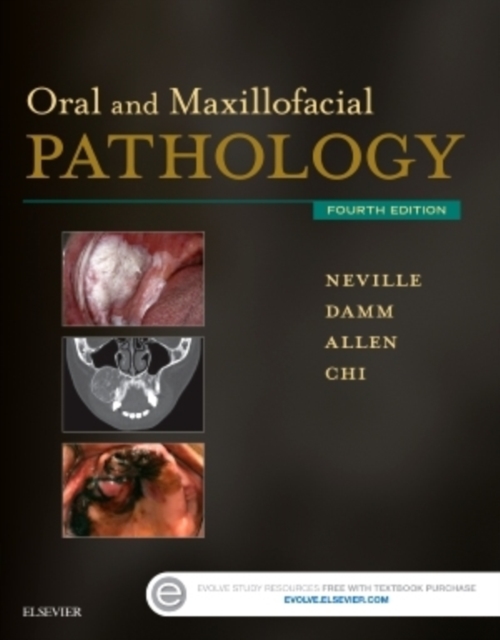Oral and Maxillofacial Pathology, Hardback Book