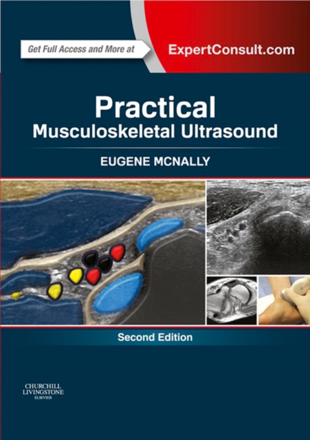 Practical Musculoskeletal Ultrasound E-Book : Practical Musculoskeletal Ultrasound E-Book, EPUB eBook