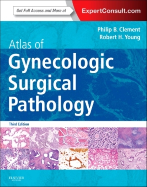 Atlas of Gynecologic Surgical Pathology : Expert Consult: Online and Print, Hardback Book