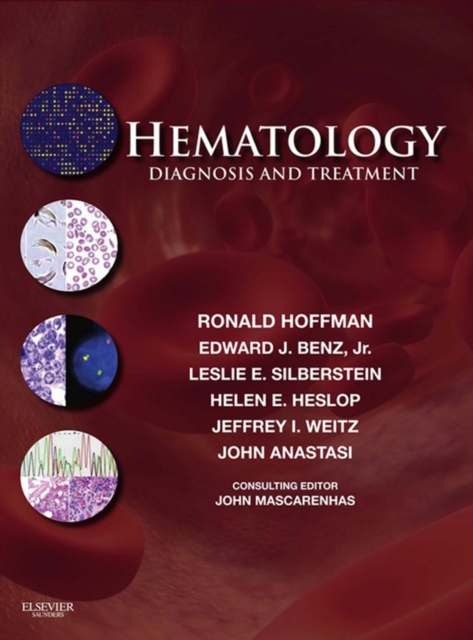 Hematology: Diagnosis and Treatment E-Book, EPUB eBook