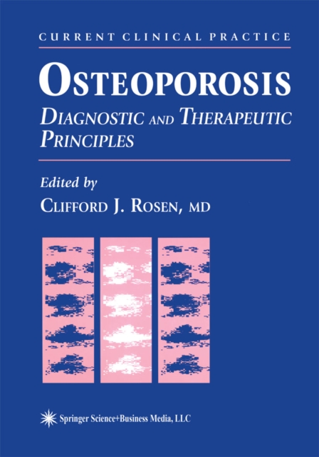 Osteoporosis : Diagnostic and Therapeutic Principles, PDF eBook