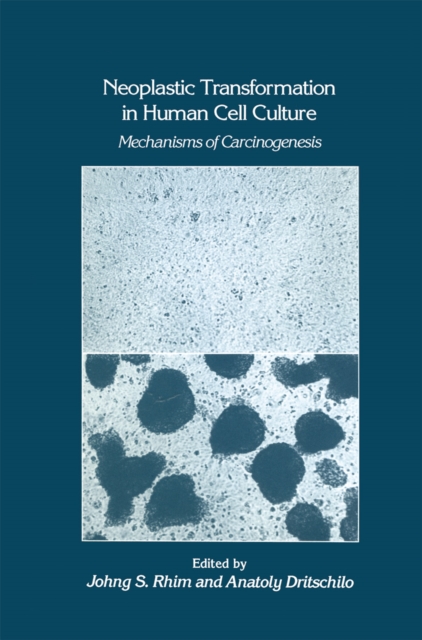 Neoplastic Transformation in Human Cell Culture : Mechanisms of Carcinogenesis, PDF eBook