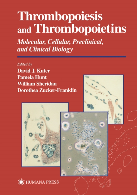 Thrombopoiesis and Thrombopoietins : Molecular, Cellular, Preclinical, and Clinical Biology, PDF eBook