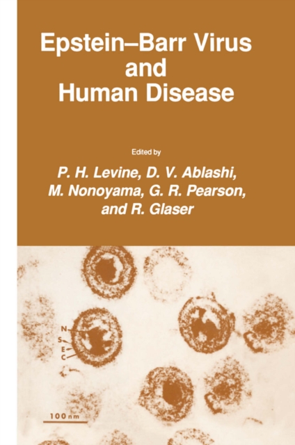 Epstein-Barr Virus and Human Disease, PDF eBook