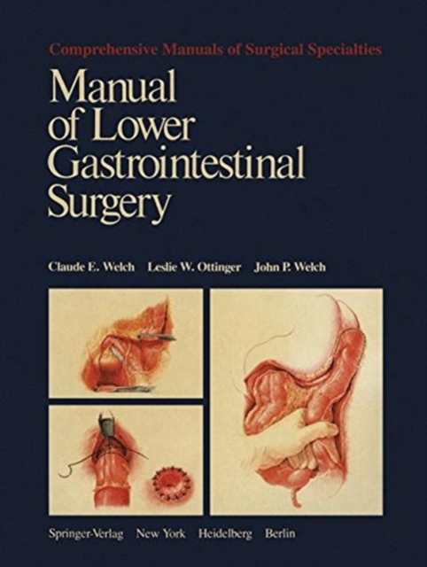 Manual of Lower Gastrointestinal Surgery, Paperback / softback Book