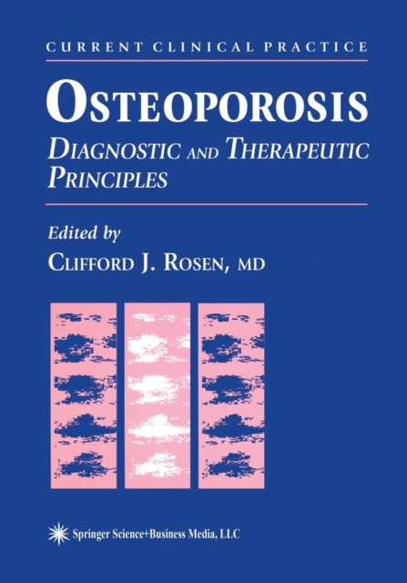 Osteoporosis : Diagnostic and Therapeutic Principles, Paperback / softback Book