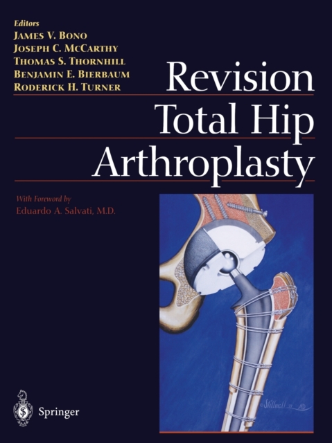 Revision Total Hip Arthroplasty, Paperback / softback Book