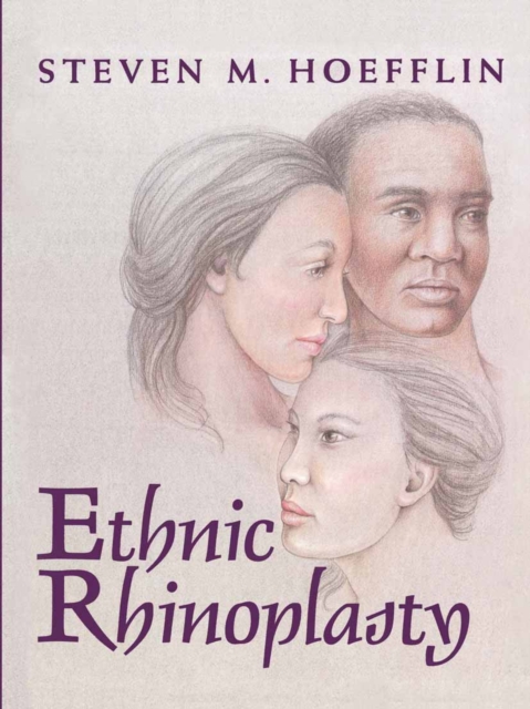 Ethnic Rhinoplasty, Paperback / softback Book