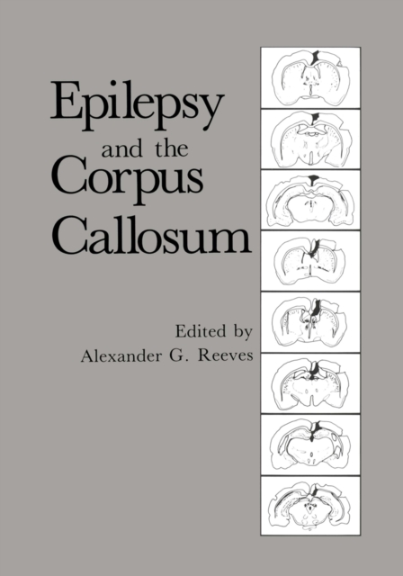 Epilepsy and the Corpus Callosum, PDF eBook
