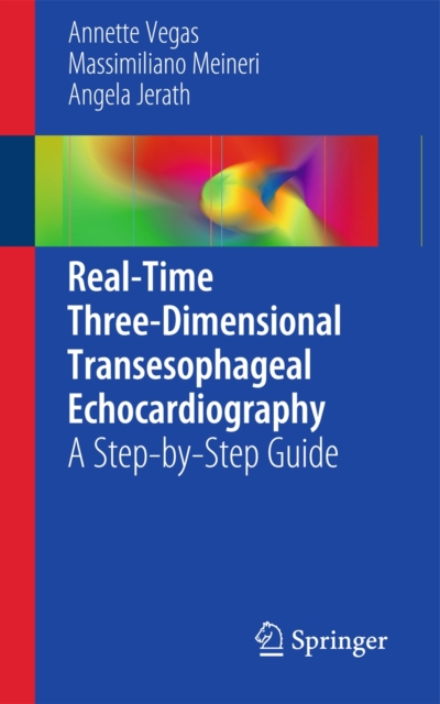 Real-Time Three-Dimensional Transesophageal Echocardiography : A Step-by-Step Guide, Paperback / softback Book