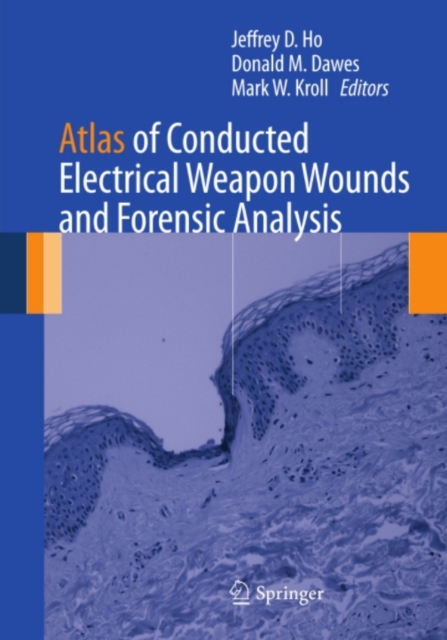 Atlas of Conducted Electrical Weapon Wounds and Forensic Analysis, PDF eBook