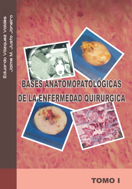 Bases Anatomopatologicas De La Enfermedad Quirurgica : Tomo I, EPUB eBook