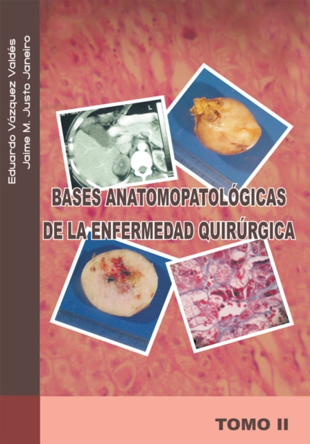 Bases Anatomopatologicas De La Enfermedad Quirurgica : Tomo Ii, EPUB eBook