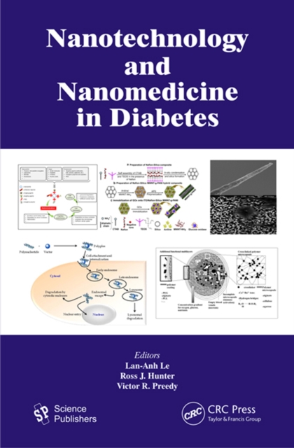 Nanotechnology and Nanomedicine in Diabetes, PDF eBook