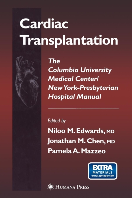 Cardiac Transplantation : The Columbia University Medical Center/New York-Presbyterian Hospital Manual, Paperback / softback Book