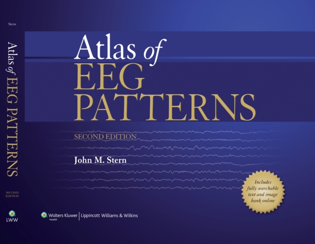 Atlas of EEG Patterns, PDF eBook