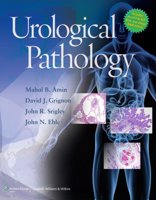 Urological Pathology, EPUB eBook