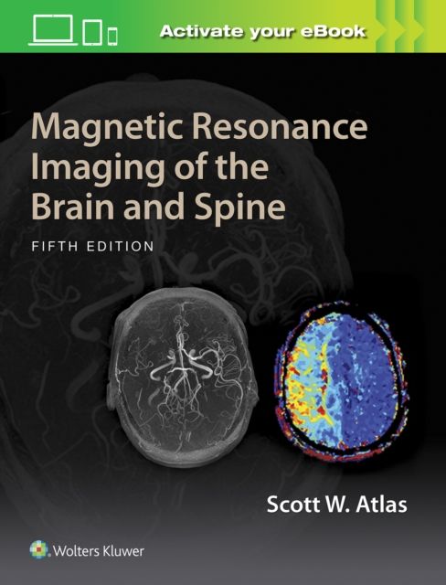Magnetic Resonance Imaging of the Brain and Spine, Hardback Book