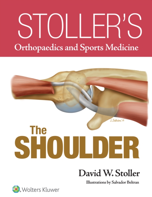 Stoller’s Orthopaedics and Sports Medicine: The Shoulder, Hardback Book