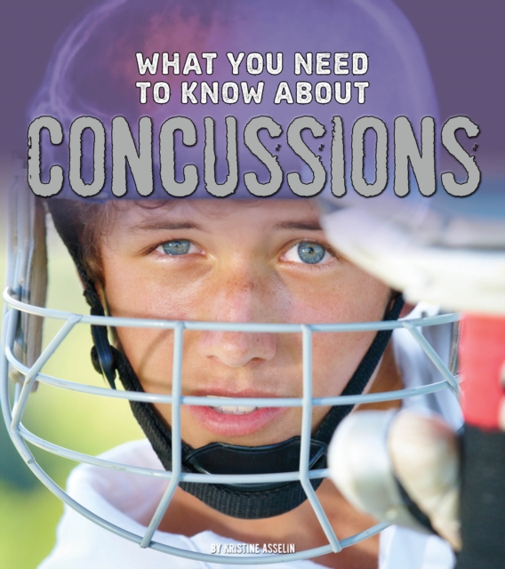 What You Need to Know About Concussions, Hardback Book