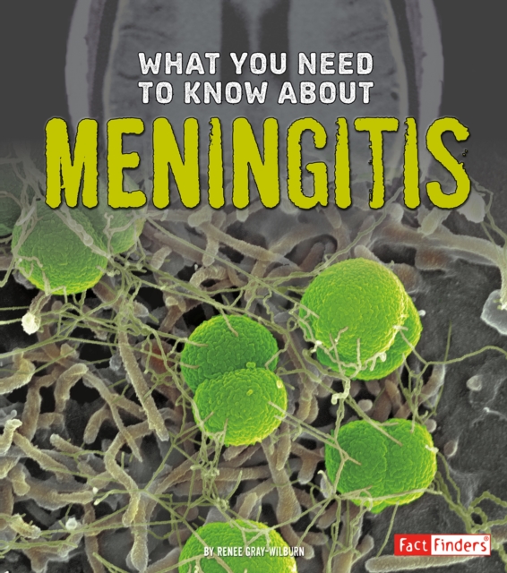 What You Need to Know about Meningitis, Hardback Book