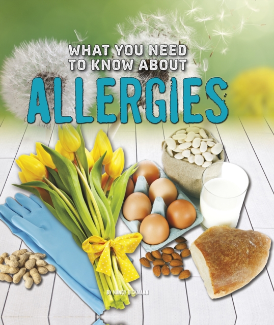 What You Need to Know About Allergies, Hardback Book