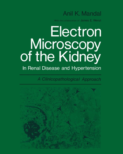 Electron Microscopy of the Kidney : In Renal Disease and Hypertension: A Clinicopathological Approach, PDF eBook