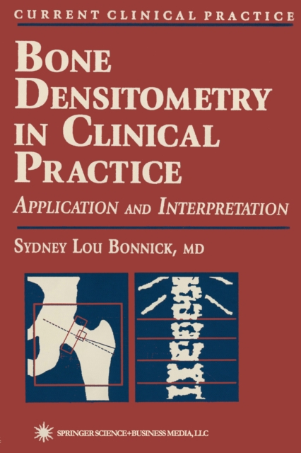Bone Densitometry in Clinical Practice, PDF eBook