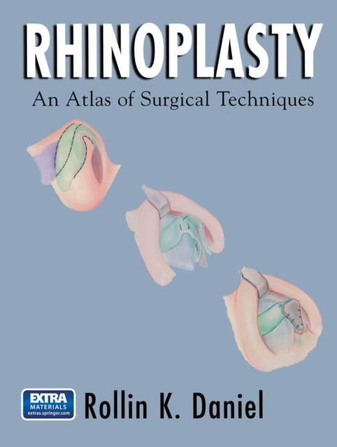 Rhinoplasty : An Atlas of Surgical Techniques, PDF eBook