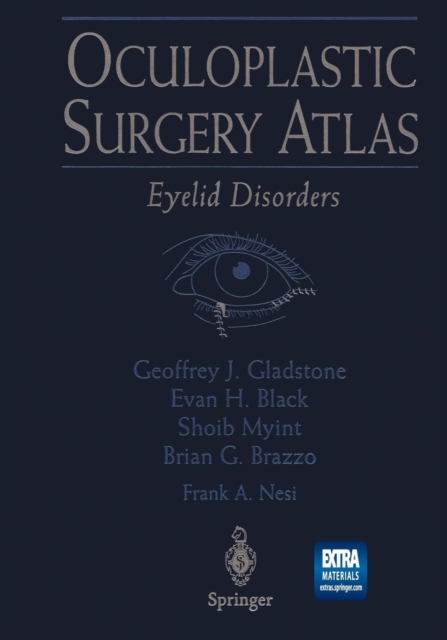 Oculoplastic Surgery Atlas : Eyelid Disorders, Paperback / softback Book