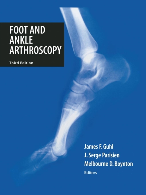 Foot and Ankle Arthroscopy, Paperback / softback Book