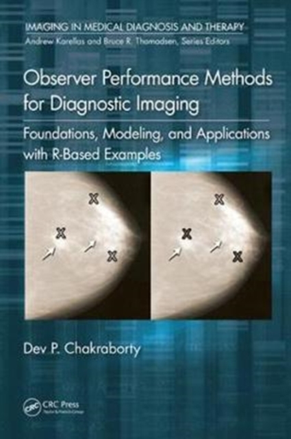 Observer Performance Methods for Diagnostic Imaging : Foundations, Modeling, and Applications with R-Based Examples, Hardback Book