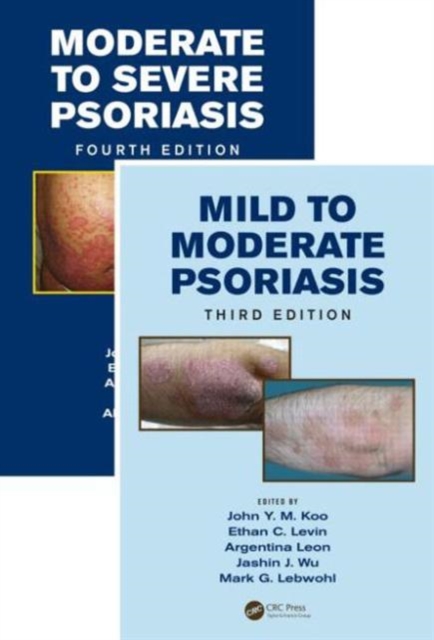 Mild to Moderate and Moderate to Severe Psoriasis (Set), Multiple-component retail product Book