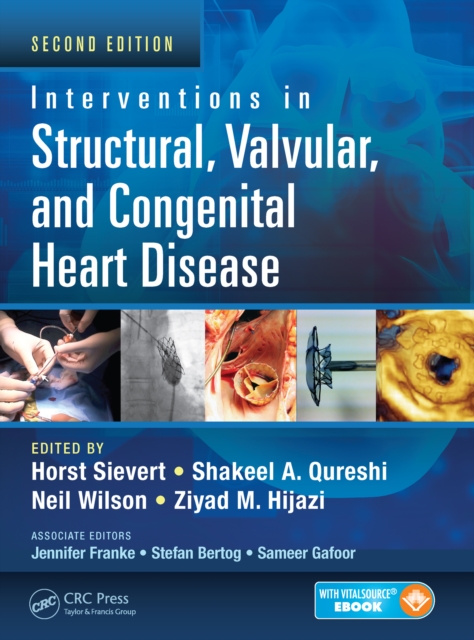 Interventions in Structural, Valvular and Congenital Heart Disease, PDF eBook