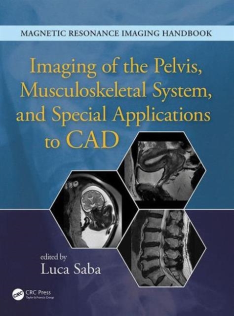 Imaging of the Pelvis, Musculoskeletal System, and Special Applications to CAD, Hardback Book