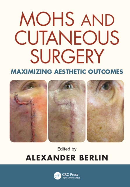 Mohs and Cutaneous Surgery : Maximizing Aesthetic Outcomes, PDF eBook