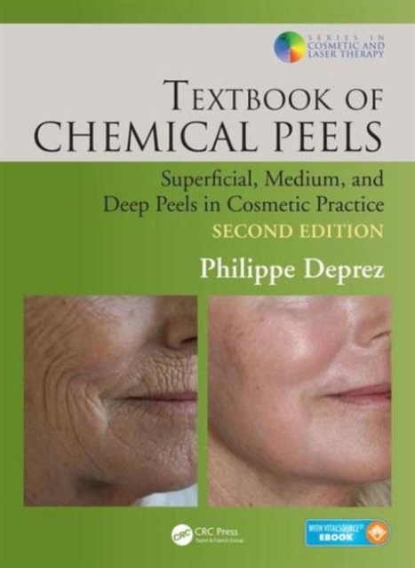 Textbook of Chemical Peels : Superficial, Medium, and Deep Peels in Cosmetic Practice, Hardback Book