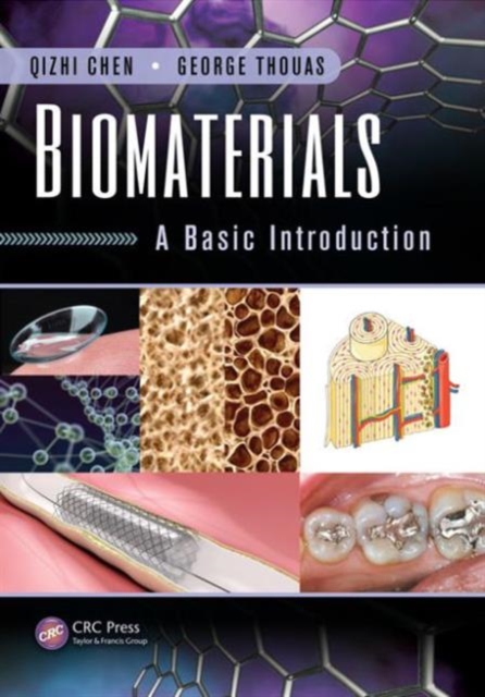 Biomaterials : A Basic Introduction, Hardback Book