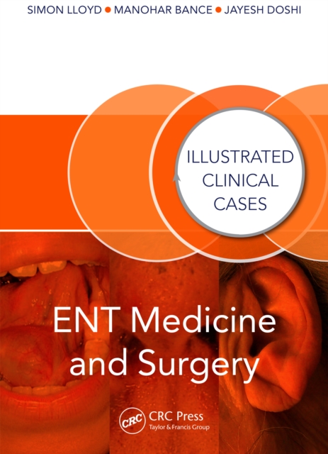 ENT Medicine and Surgery : Illustrated Clinical Cases, PDF eBook