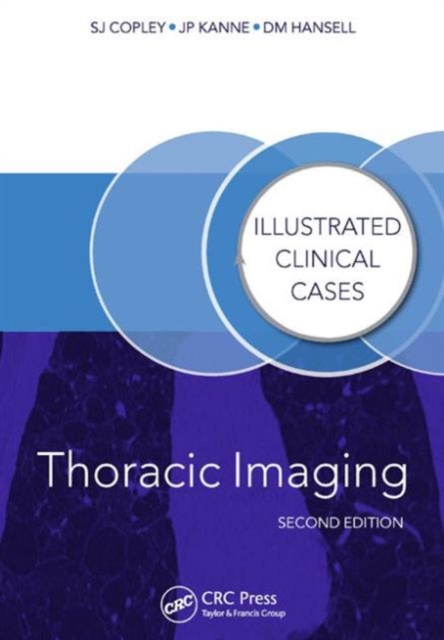 Thoracic Imaging : Illustrated Clinical Cases, Second Edition, Paperback / softback Book