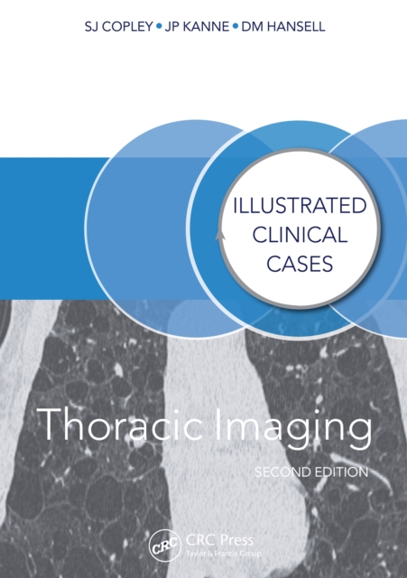 Thoracic Imaging : Illustrated Clinical Cases, Second Edition, PDF eBook