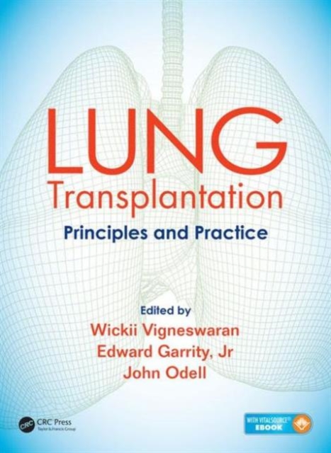 Lung Transplantation : Principles and Practice, Hardback Book