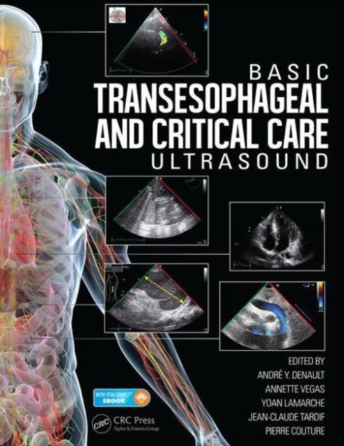 Basic Transesophageal and Critical Care Ultrasound, Hardback Book
