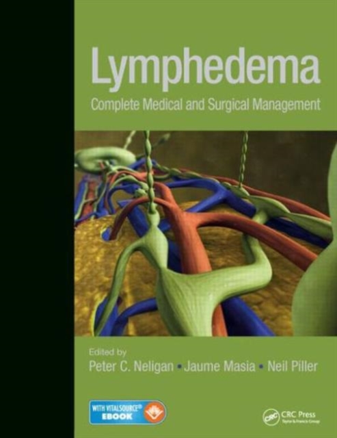 Lymphedema : Complete Medical and Surgical Management, Electronic book text Book