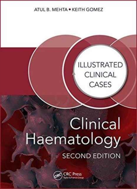 Clinical Haematology : Illustrated Clinical Cases, Paperback / softback Book