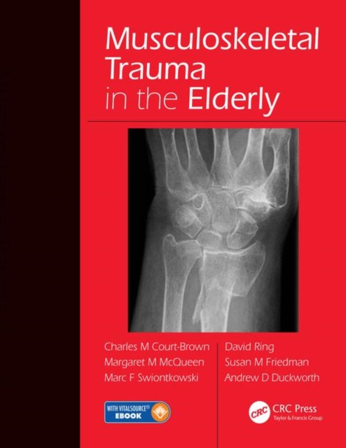 Musculoskeletal Trauma in the Elderly, Hardback Book