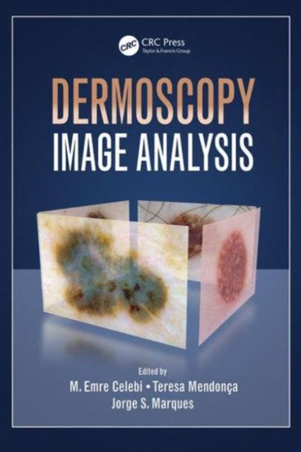 Dermoscopy Image Analysis, Hardback Book